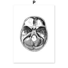 Load image into Gallery viewer, Black And White Brain Heart Skull kidney Anatomy Wall Art Canvas Painting Nordic Posters And Prints Wall Pictures Office Decor - SallyHomey Life's Beautiful