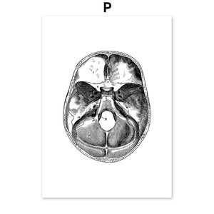 Black And White Brain Heart Skull kidney Anatomy Wall Art Canvas Painting Nordic Posters And Prints Wall Pictures Office Decor - SallyHomey Life's Beautiful
